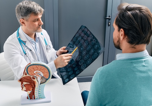 TBI and Memory Loss